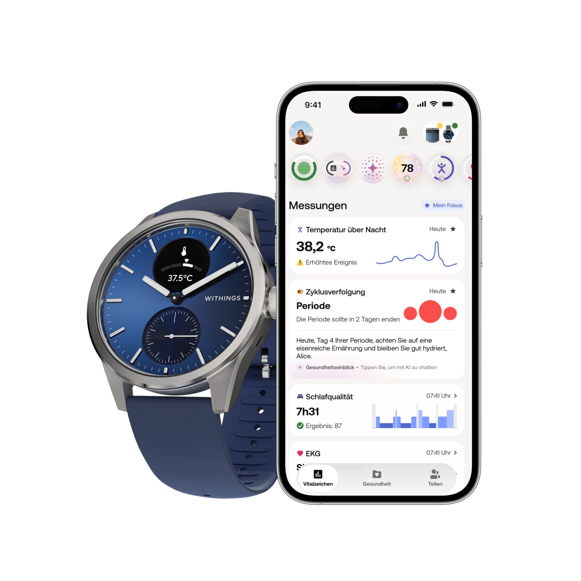 Armbanduhr, Arm, Elektronik, Telefon, Handy, Armbanduhr, Arm, Körperteil, Person, Elektronik
